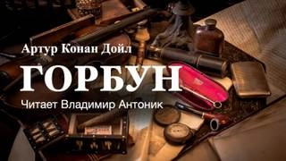 Горбун - Артур Конан Дойл » - современные аудиокниги попаданцы мр3 слушать на лучшем сайте booksaudio-online.com