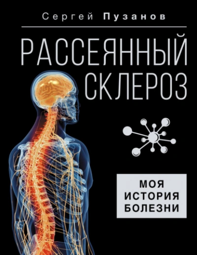 Рассеянный склероз. Моя история болезни - Сергей Пузанов - современные аудиокниги попаданцы мр3 слушать на лучшем сайте booksaudio-online.com